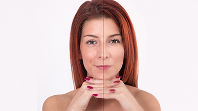 Collagen-Renew