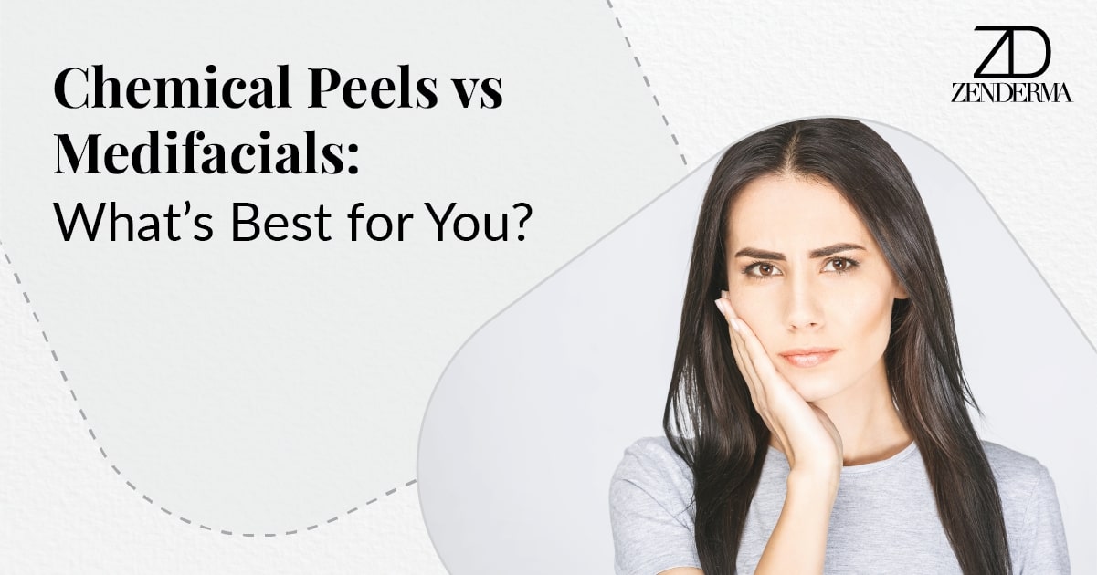 chemical peels vs medifacials