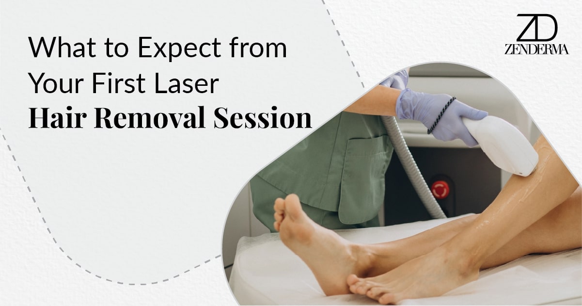 first laser hair removal session