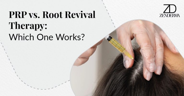 prp vs root revival therapy