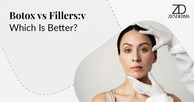 botox vs fillers