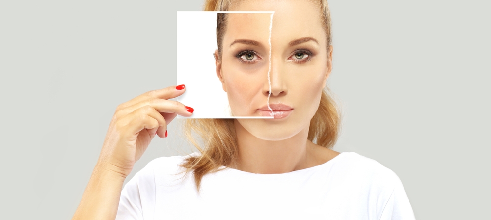 botox