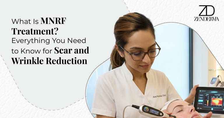 What Is MNRF Treatment? Everything You Need to Know for Scar and Wrinkle Reduction