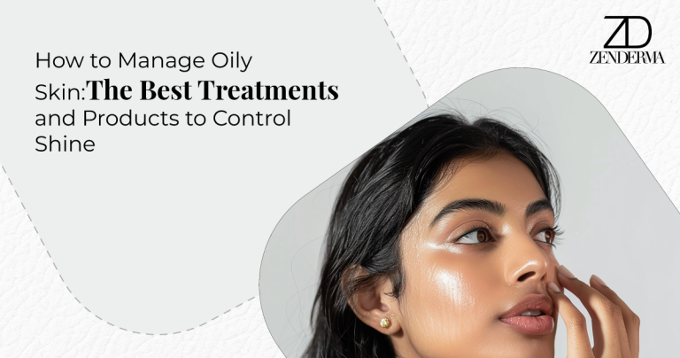 How to Manage Oily Skin: The Best Treatments and Products to Control Shine