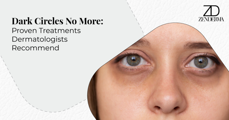 Dark Circles No More: Proven Treatments Dermatologists Recommend