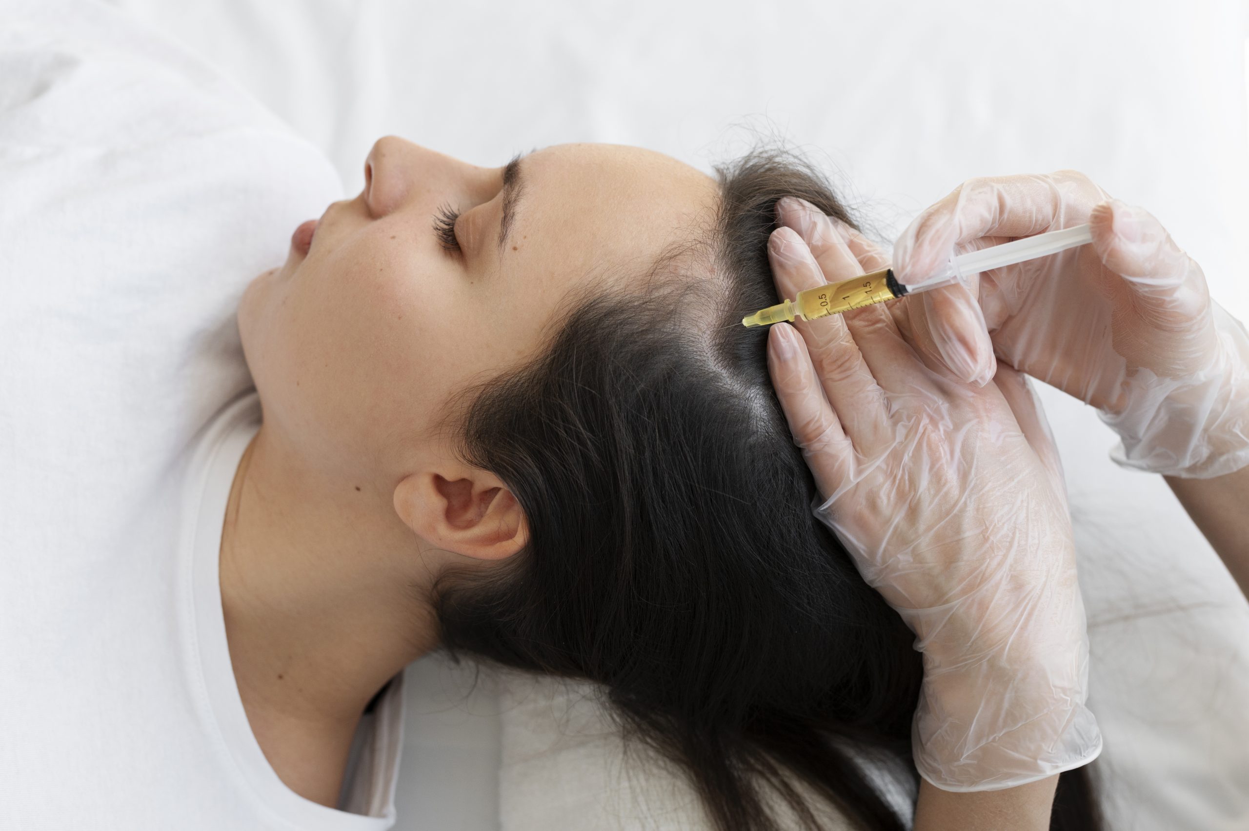 woman getting scalp treatment in chennai, high angled.