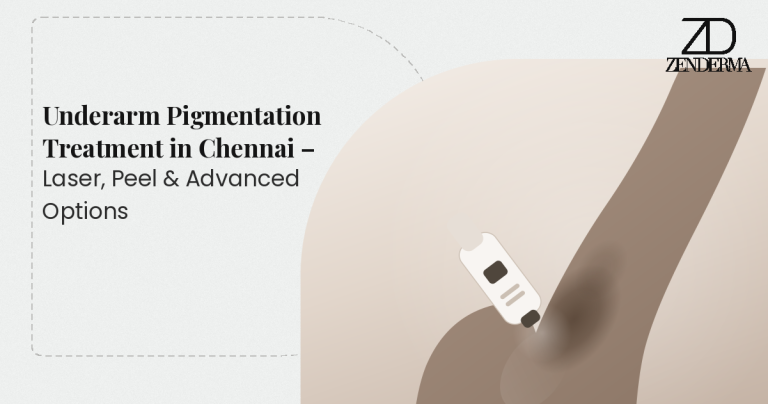 Underarm Pigmentation Treatment in Chennai – Laser, Peel & Advanced Options