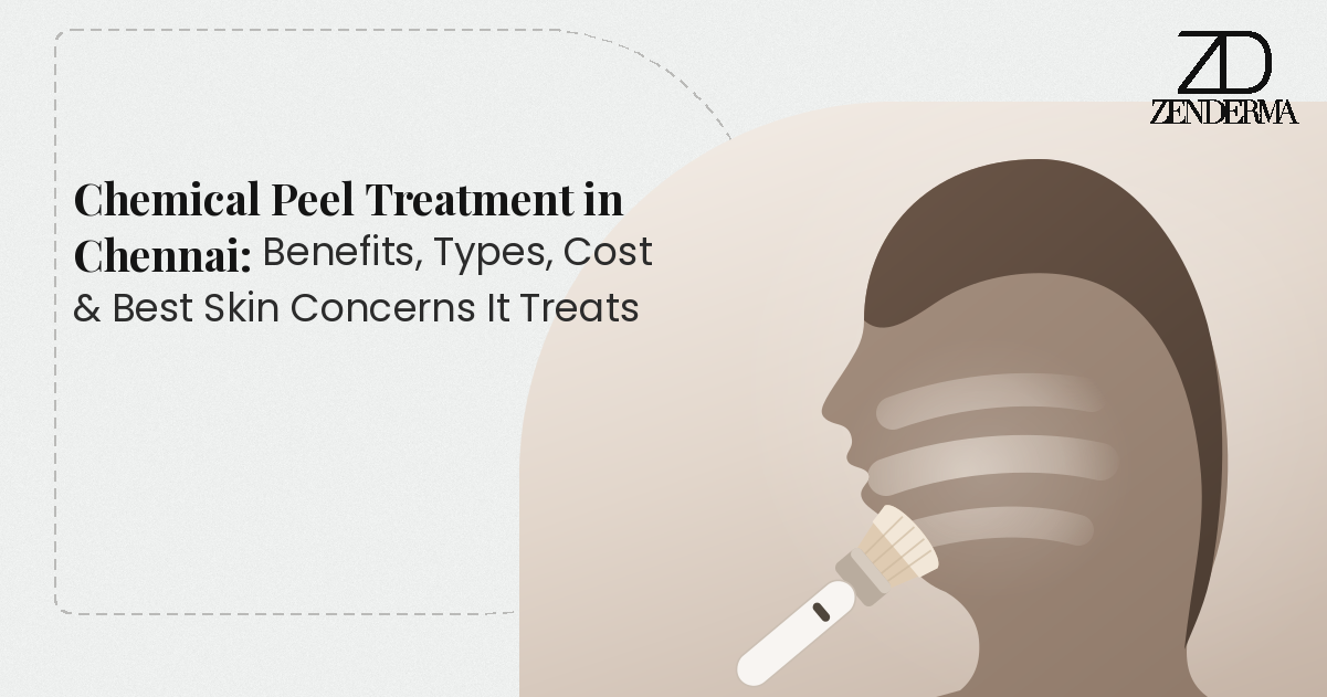 Chemical Peel Treatment in Chennai: Benefits, Types, Cost & Best Skin Concerns It Treats